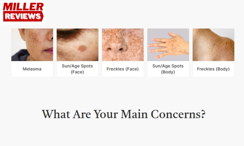 How Musely’s Prescription Skincare Works